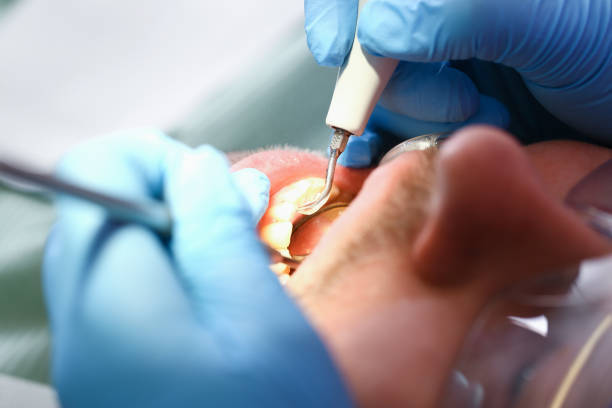 Best Walk-In Emergency Dental Services in Roman Forest, TX